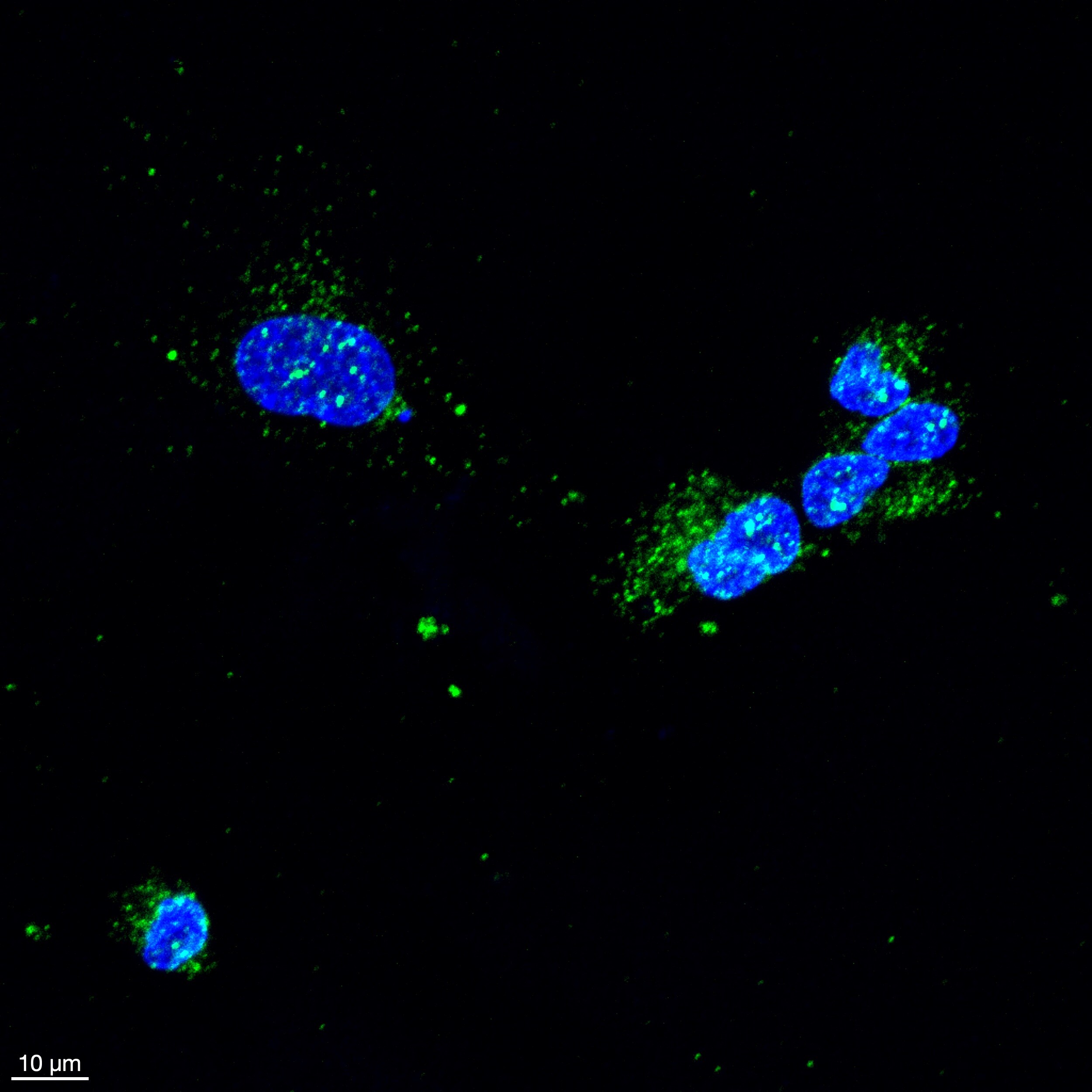 Human Galectin‑14 Antibody MAB5744