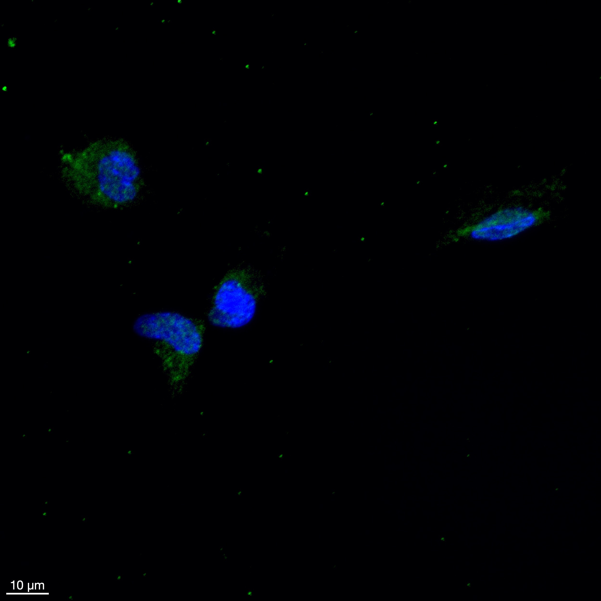 Mouse Galectin‑1 Antibody AF1245