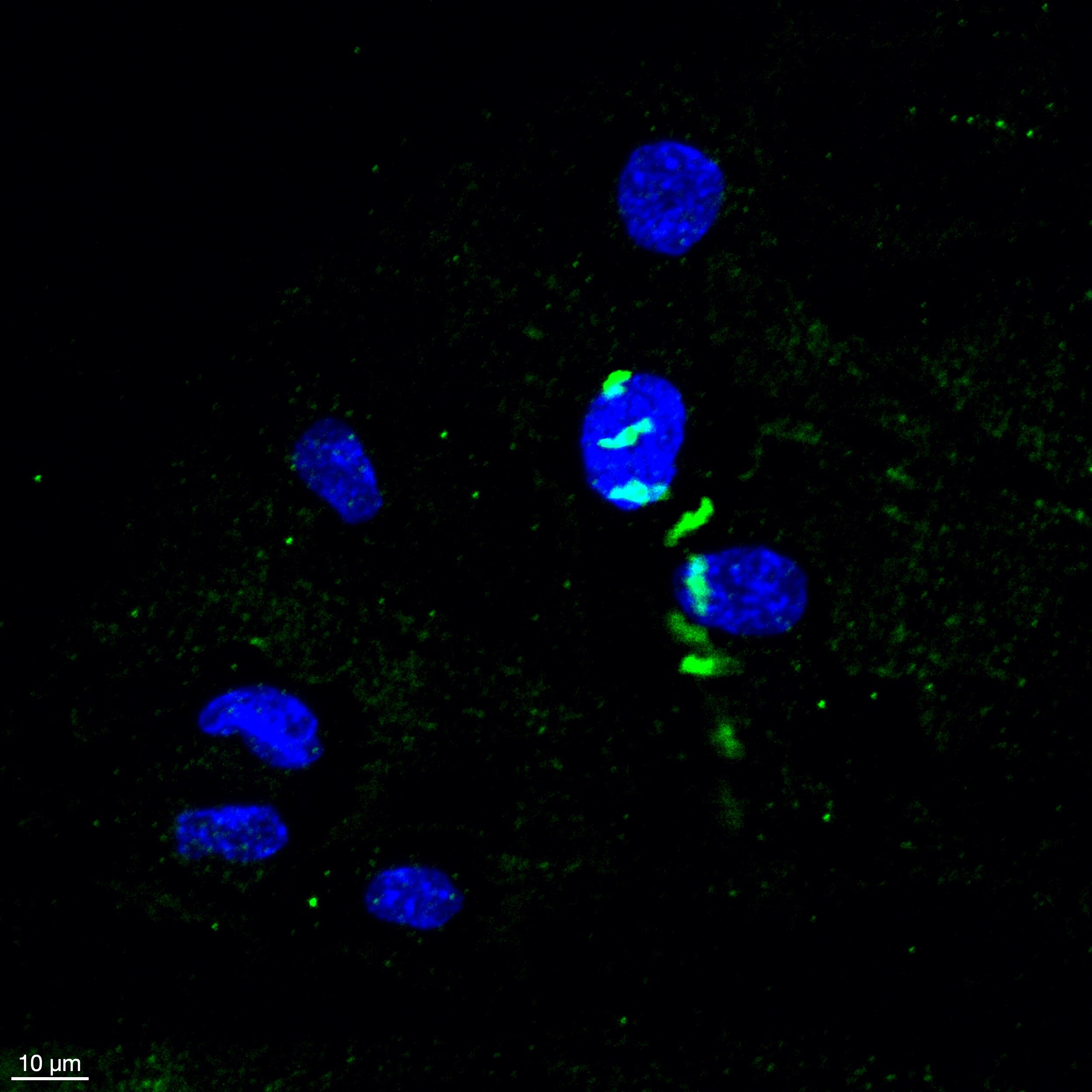 Human Galectin‑2 Antibody MAB1153