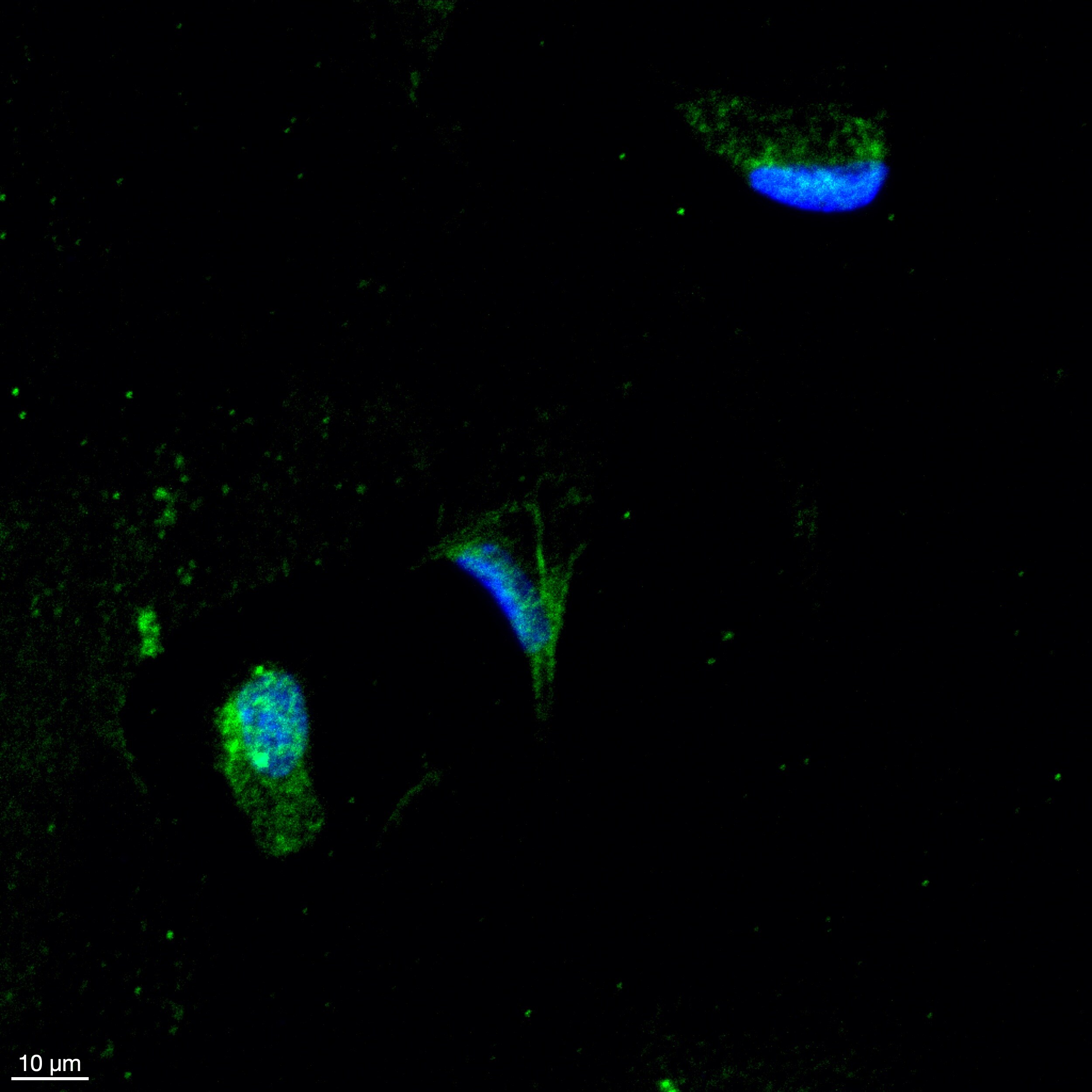 Human/Mouse/Rat Galectin‑3 Antibody AF1197