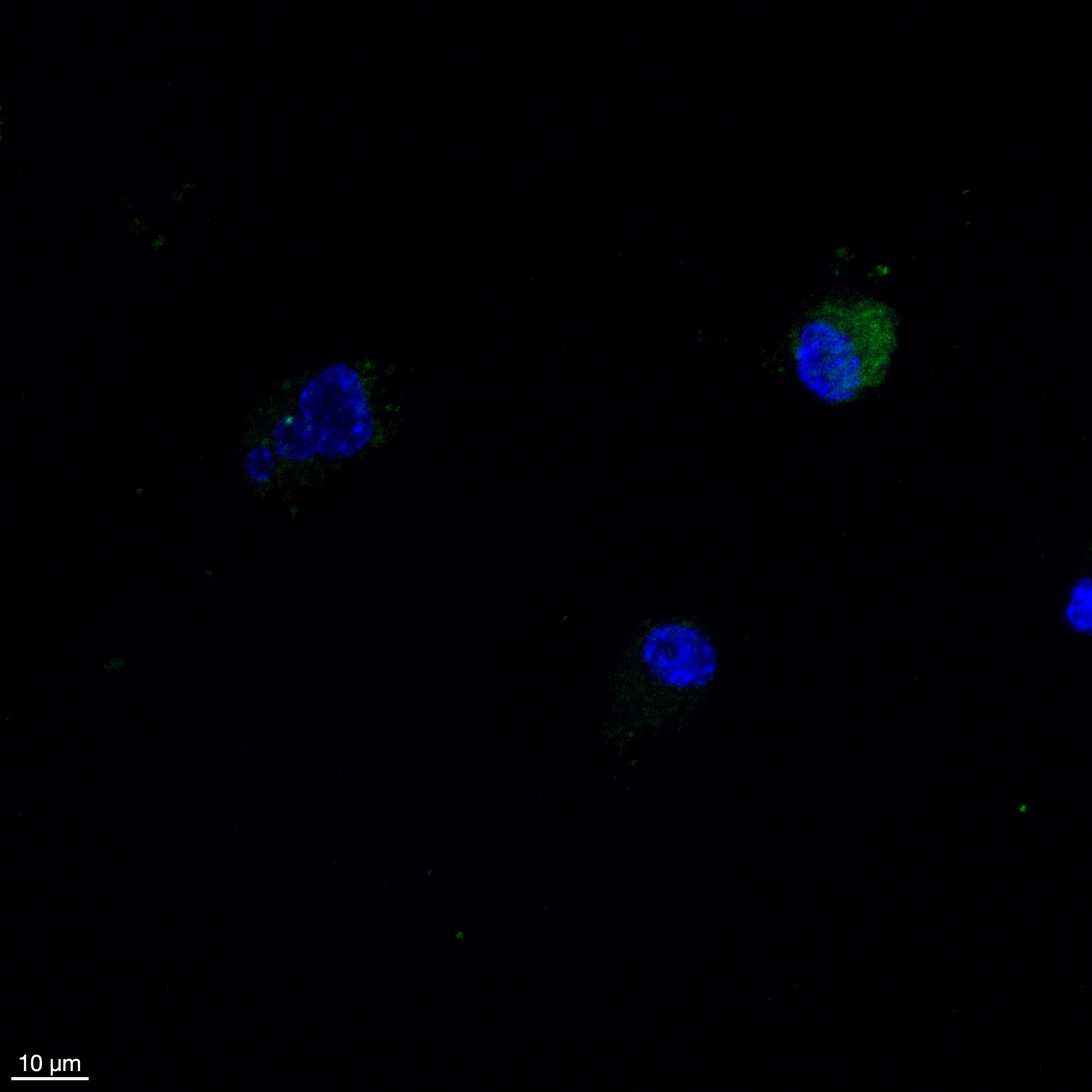 Human Galectin‑7 Antibody MAB13392