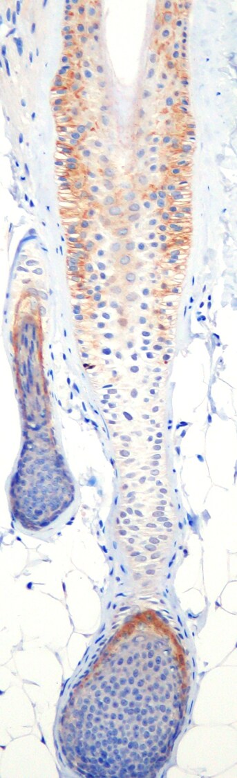 GLI-1 Antibody - BSA Free NB600-600