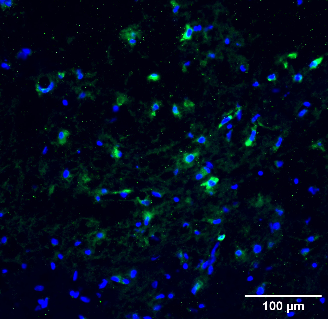 Histone H3 [Citrulline Arg17, Citrulline Arg2, Citrulline Arg8] Antibody NB100-57135