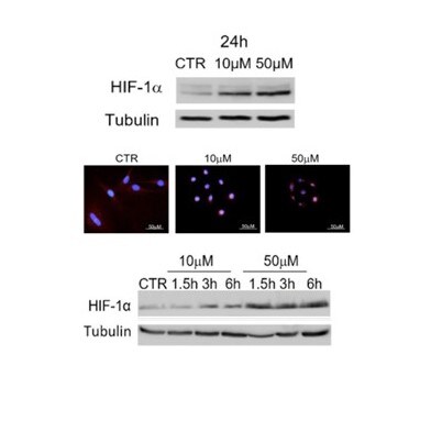 HIF-1 alpha Antibody (H1alpha67) NB100-123