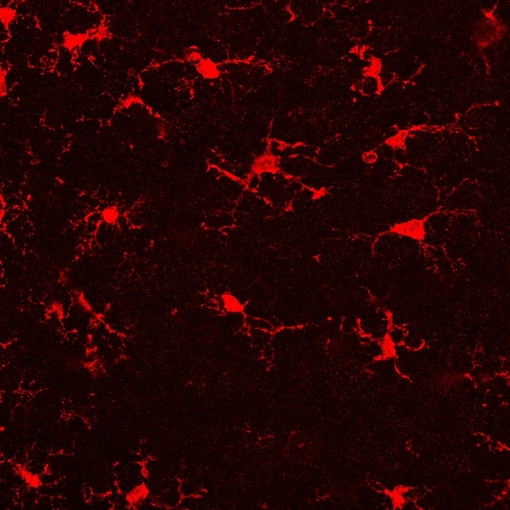 AIF-1/Iba1 Antibody NB100-1028