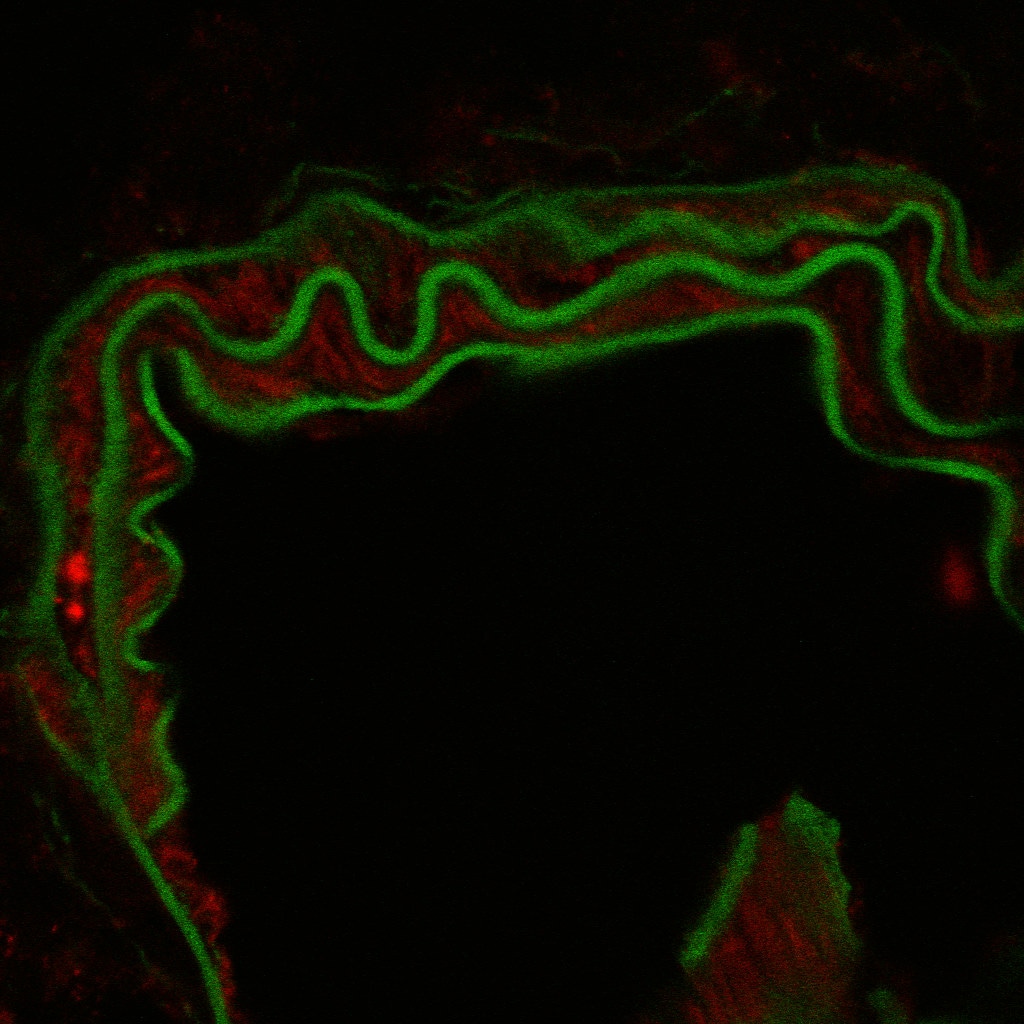 Fibronectin Antibody - BSA Free NBP1-91258