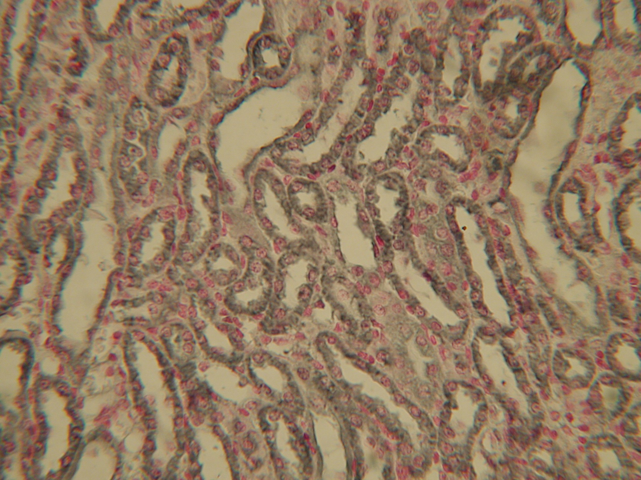 HIF-1 alpha Antibody (ESEE122) - BSA Free NB100-131