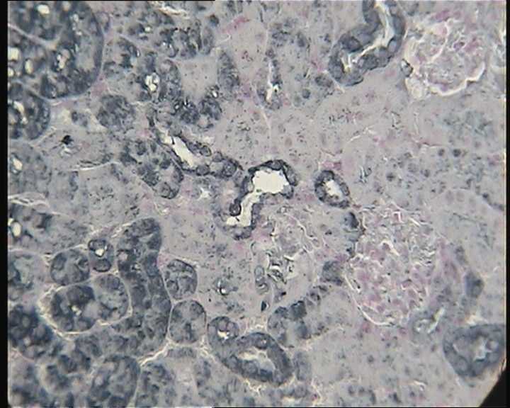 HIF-2 alpha/EPAS1 Antibody (ep190b) NB100-132