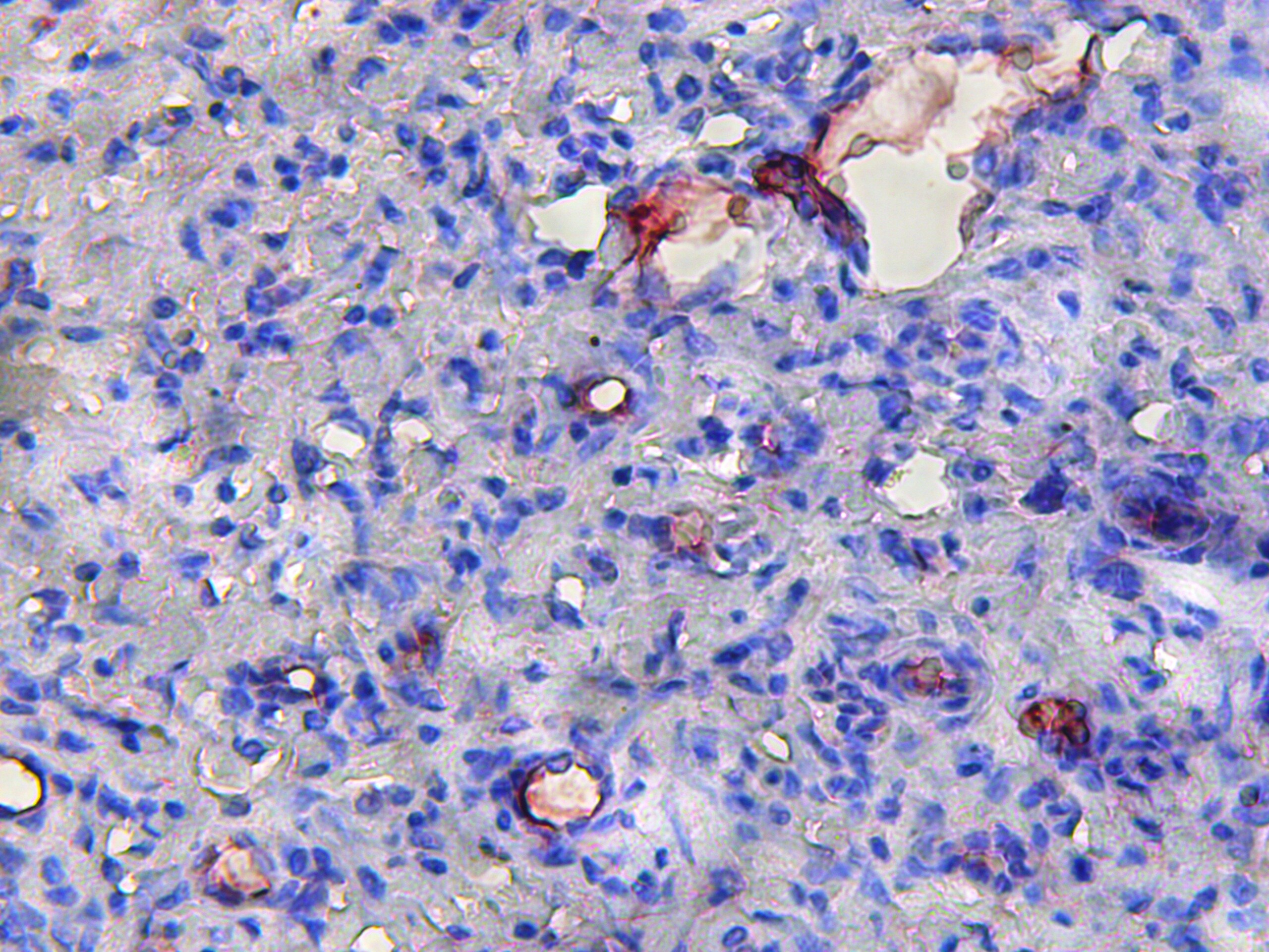 CD31/PECAM-1 Antibody (TLD-3A12) - BSA Free NB100-64796