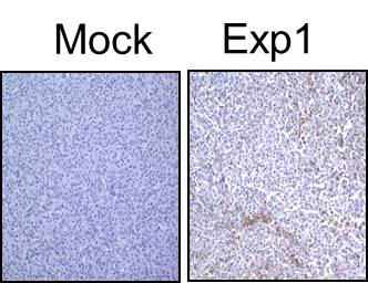 LC3B Antibody - BSA Free NB600-1384