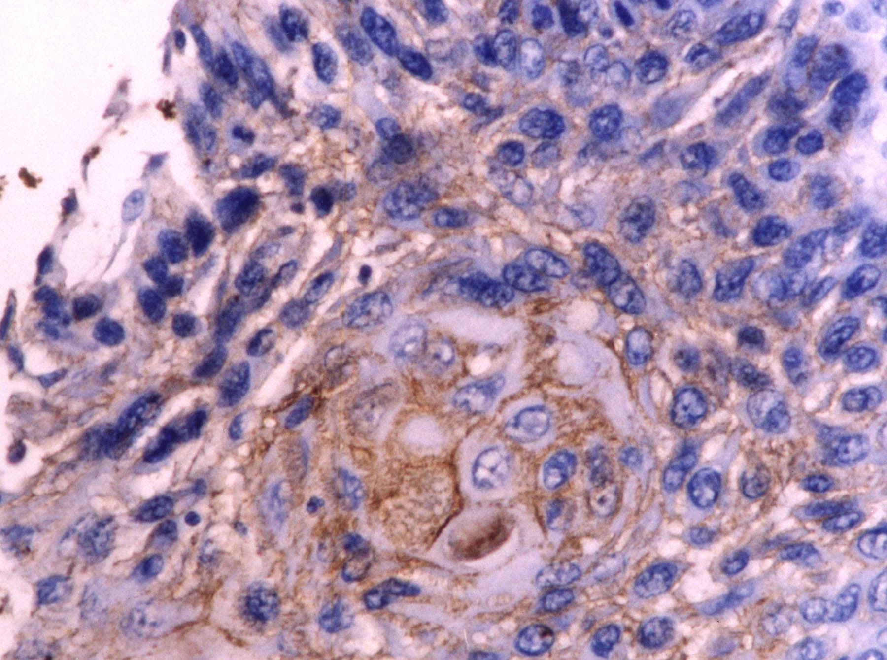 Fibronectin Antibody - BSA Free NBP1-91258