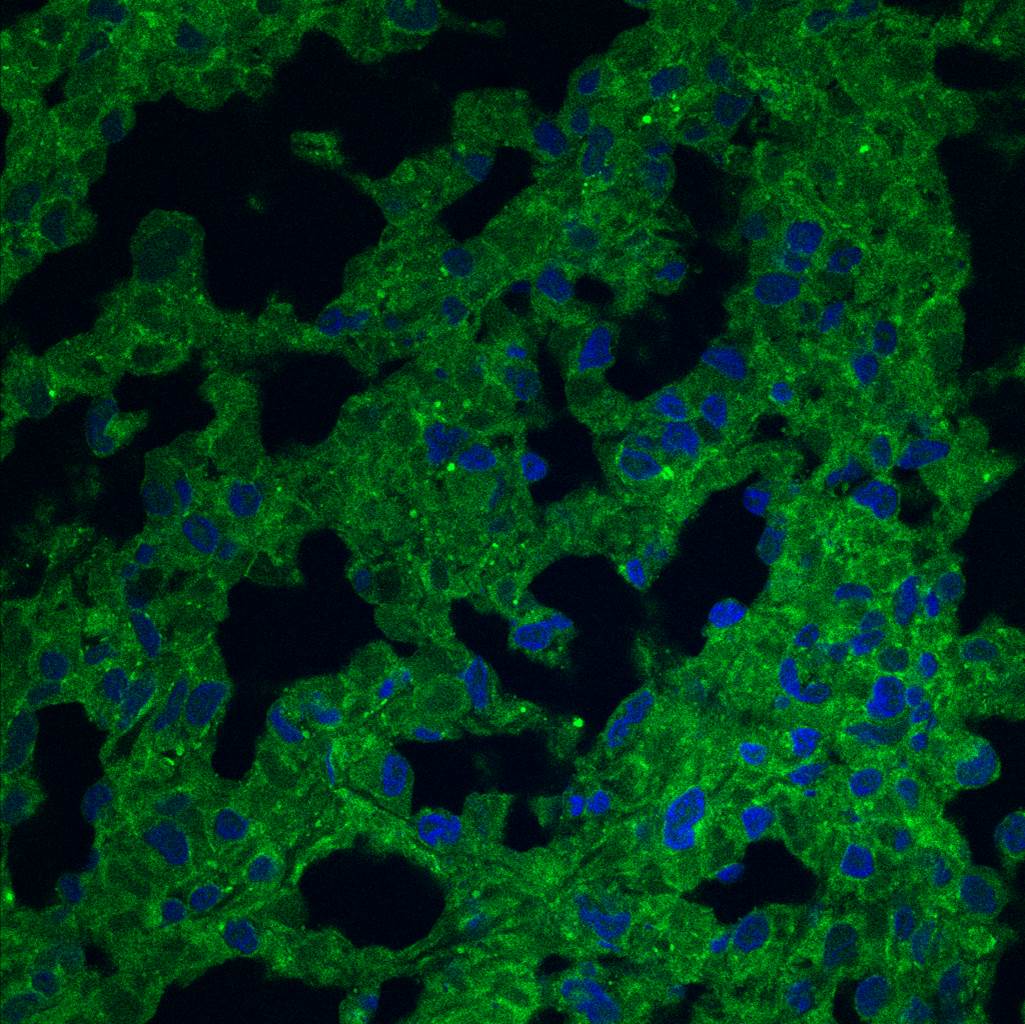 CD38 Antibody (1G7F4) [Alexa Fluor® 647] NBP2-25265AF647