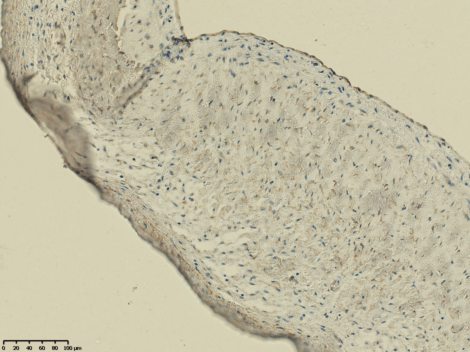 5'-Nucleotidase/CD73 Antibody - BSA Free NBP1-85740