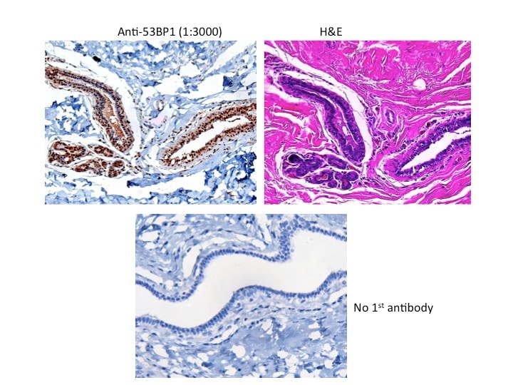 53BP1 Antibody - BSA Free NB100-304