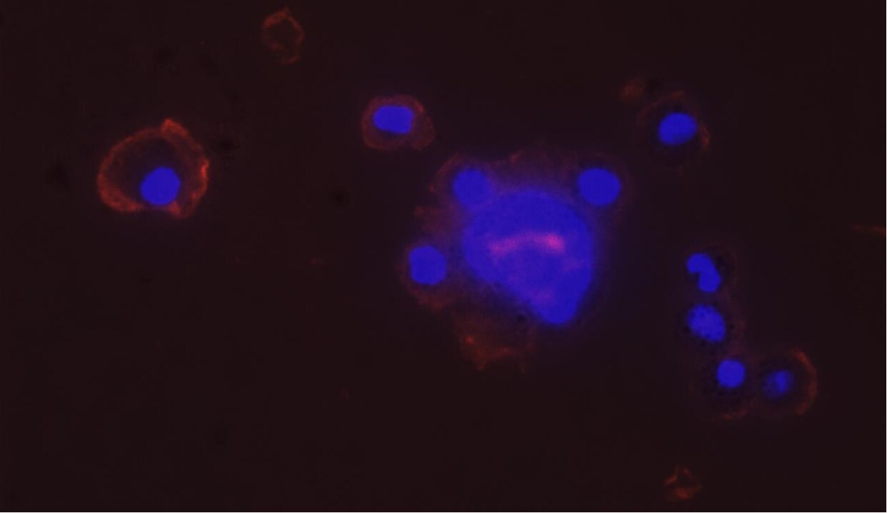 Integrin beta 2/CD18 Antibody (YFC118.3) - BSA Free NB200-610