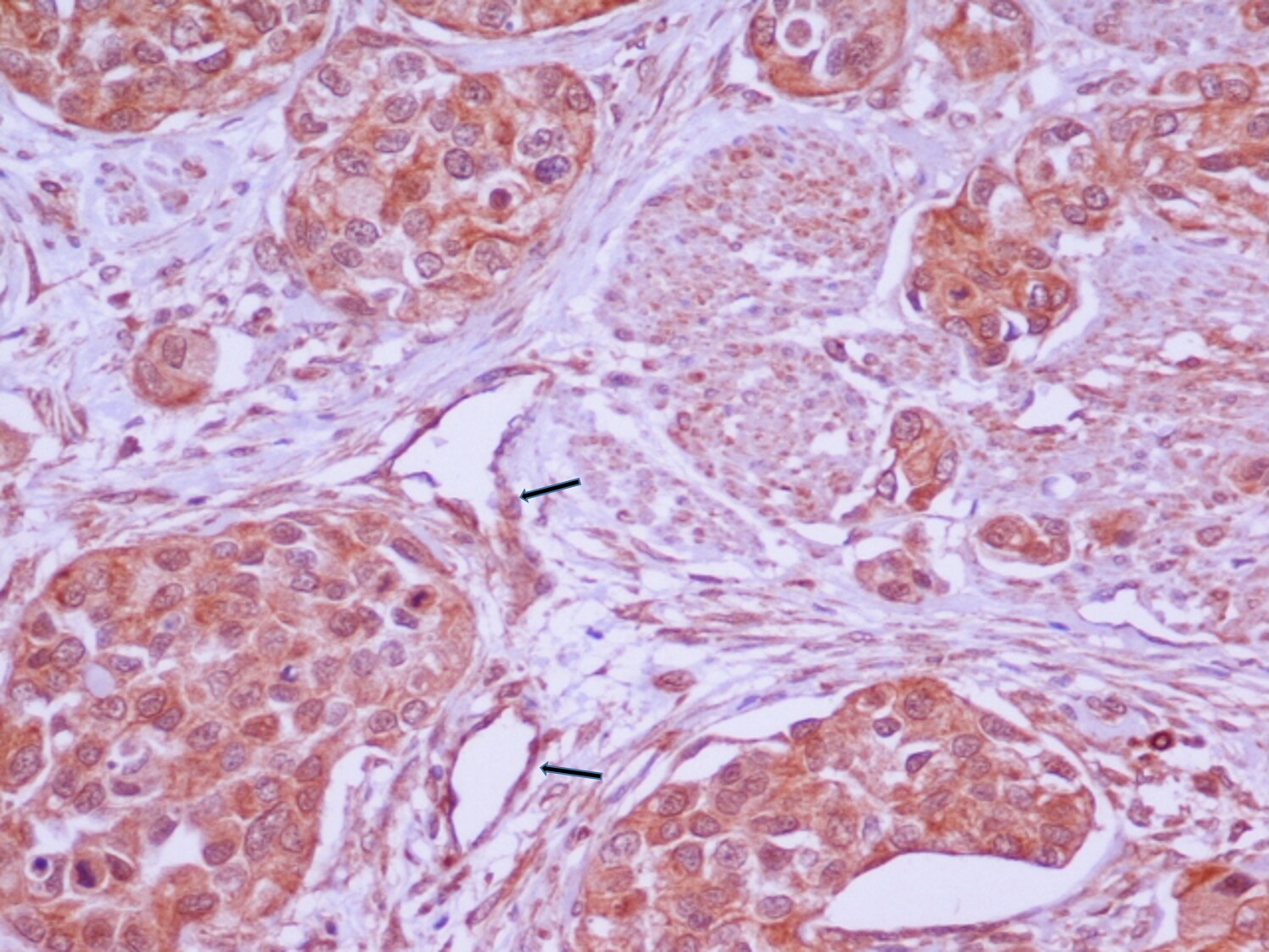 Endothelin-1 Antibody (TR.ET.48.5) - BSA Free NB300-526