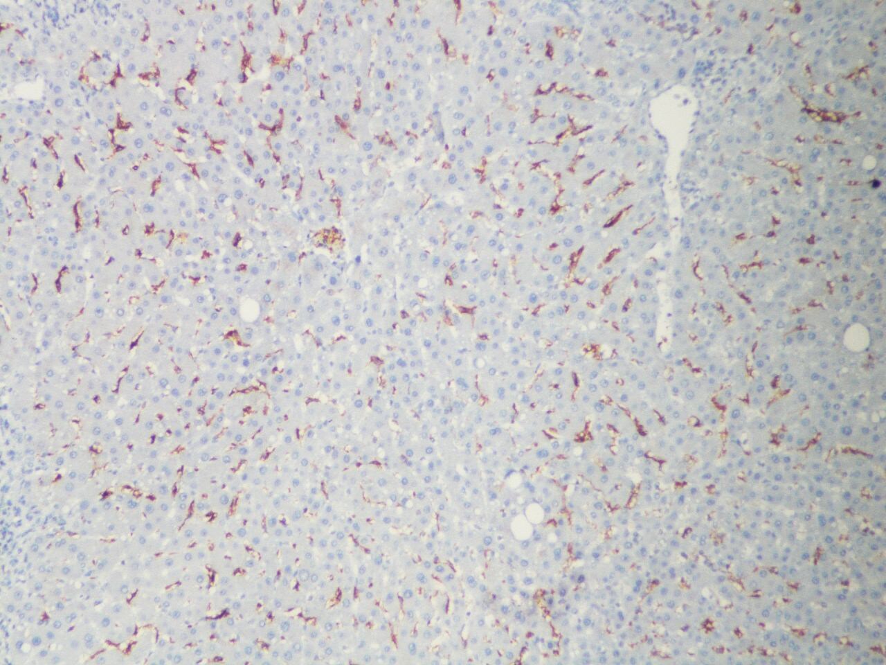MARCO Antibody - BSA Free NBP2-39004