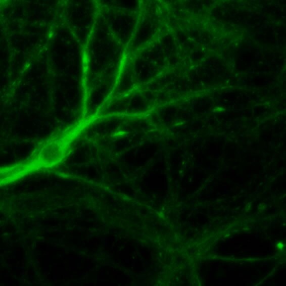 Muscarinic Acetylcholine Receptor M1/CHRM1 Antibody - BSA Free NBP1-87466