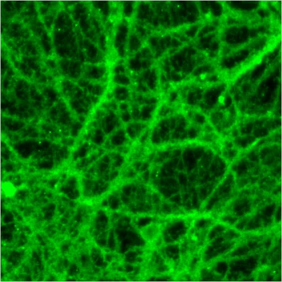 P2Y1/P2RY1 Antibody NBP1-30741