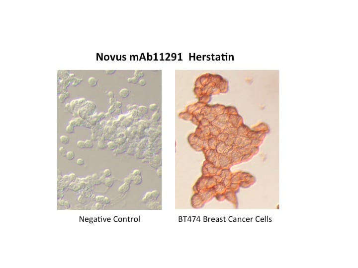 Human ErbB2/Her2 Herstatin Isoform Antibody MAB11291