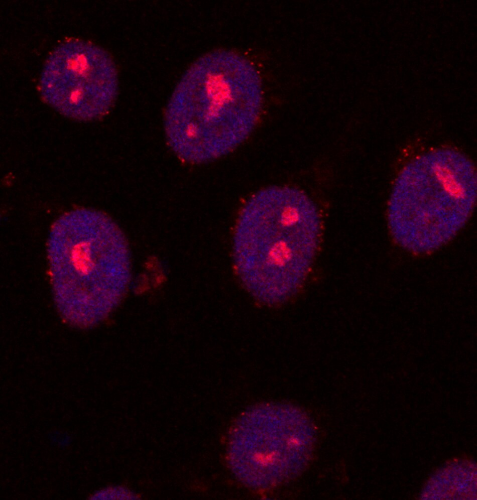 SETDB2 Antibody NB100-1137