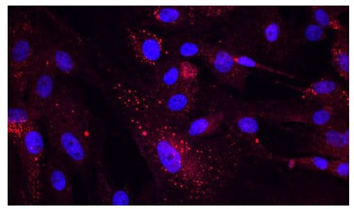 CD31/PECAM-1 Antibody NB100-2284