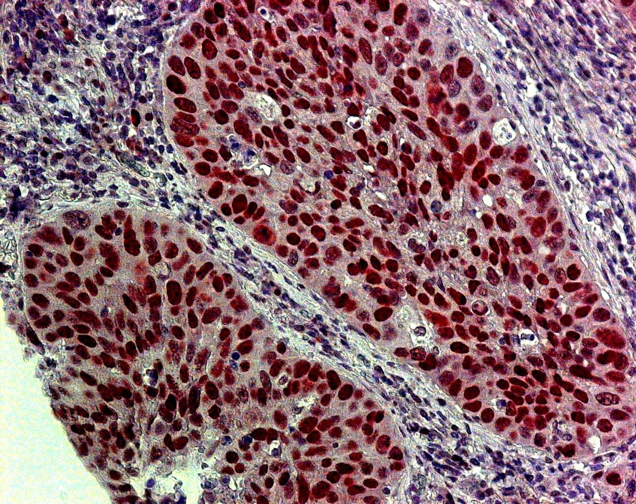 KDM2A/FBXL11 Antibody NB100-74602