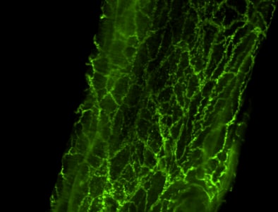 Tyrosine Hydroxylase Antibody - Azide Free NB300-109