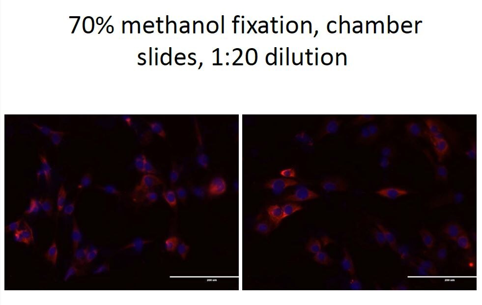 IFN-gamma R2 Antibody - BSA Free NBP1-90223