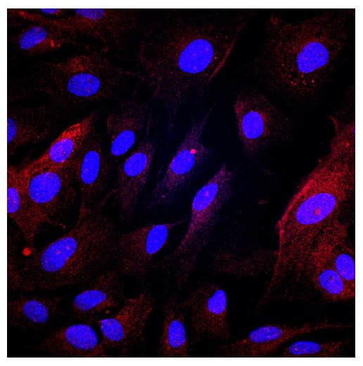 PLVAP Antibody NBP2-19868
