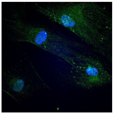 Endoglin/CD105 Antibody (3A9) - BSA Free NBP2-22122