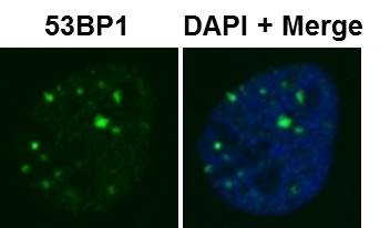 53BP1 Antibody - BSA Free NB100-904