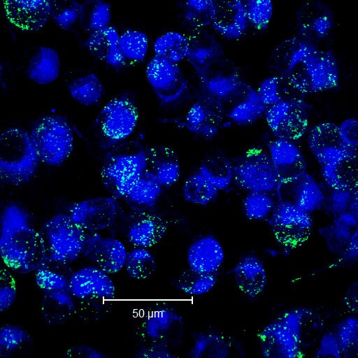 Alkaline Phosphatase/ALPP Antibody (8B6) - BSA Free NB110-3638
