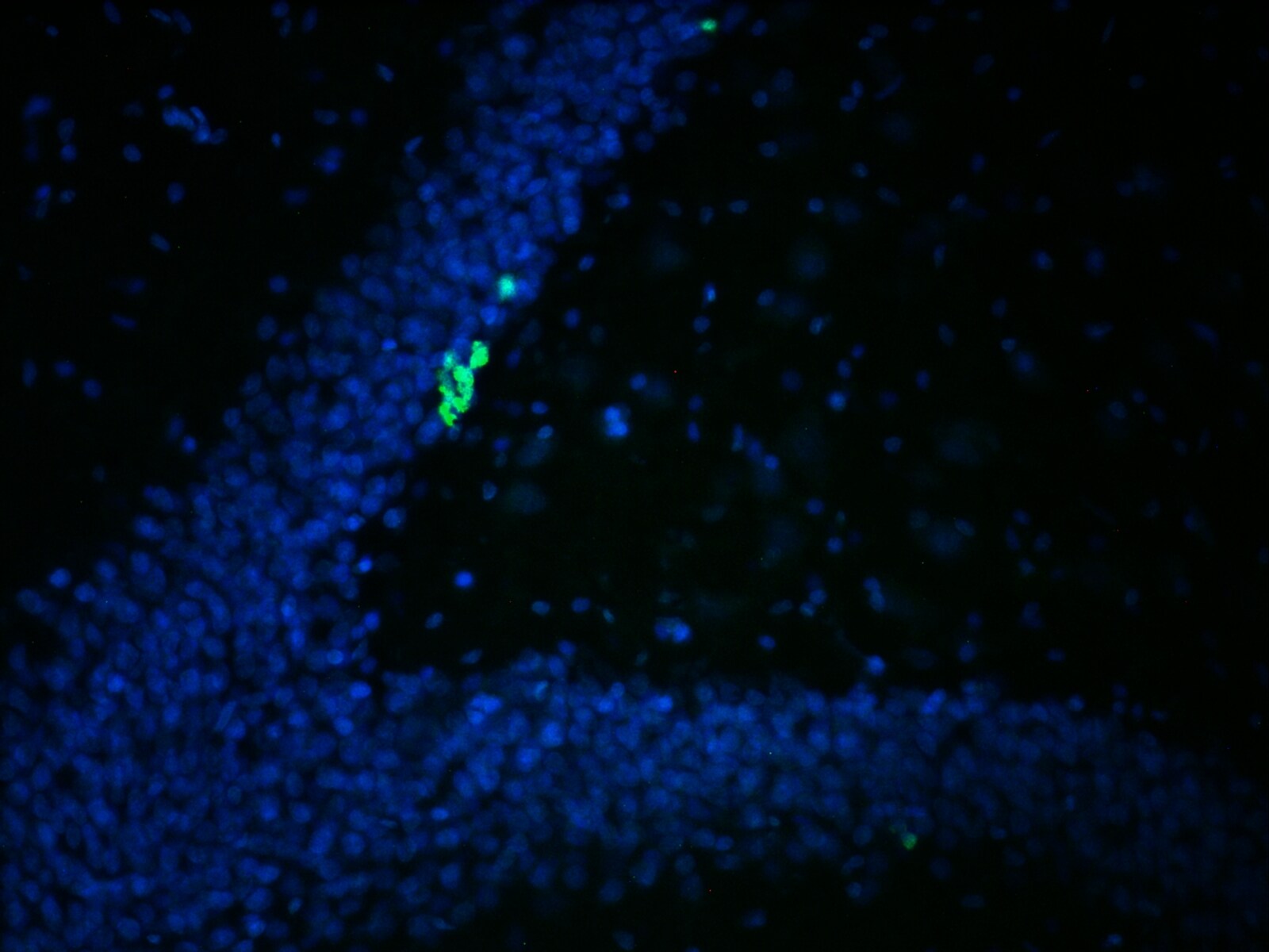 Ki67/MKI67 Antibody - BSA Free NB110-89717