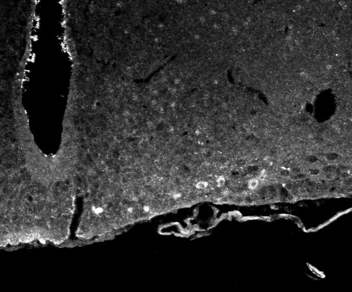 ACBD7 Antibody - BSA Free NBP1-56527