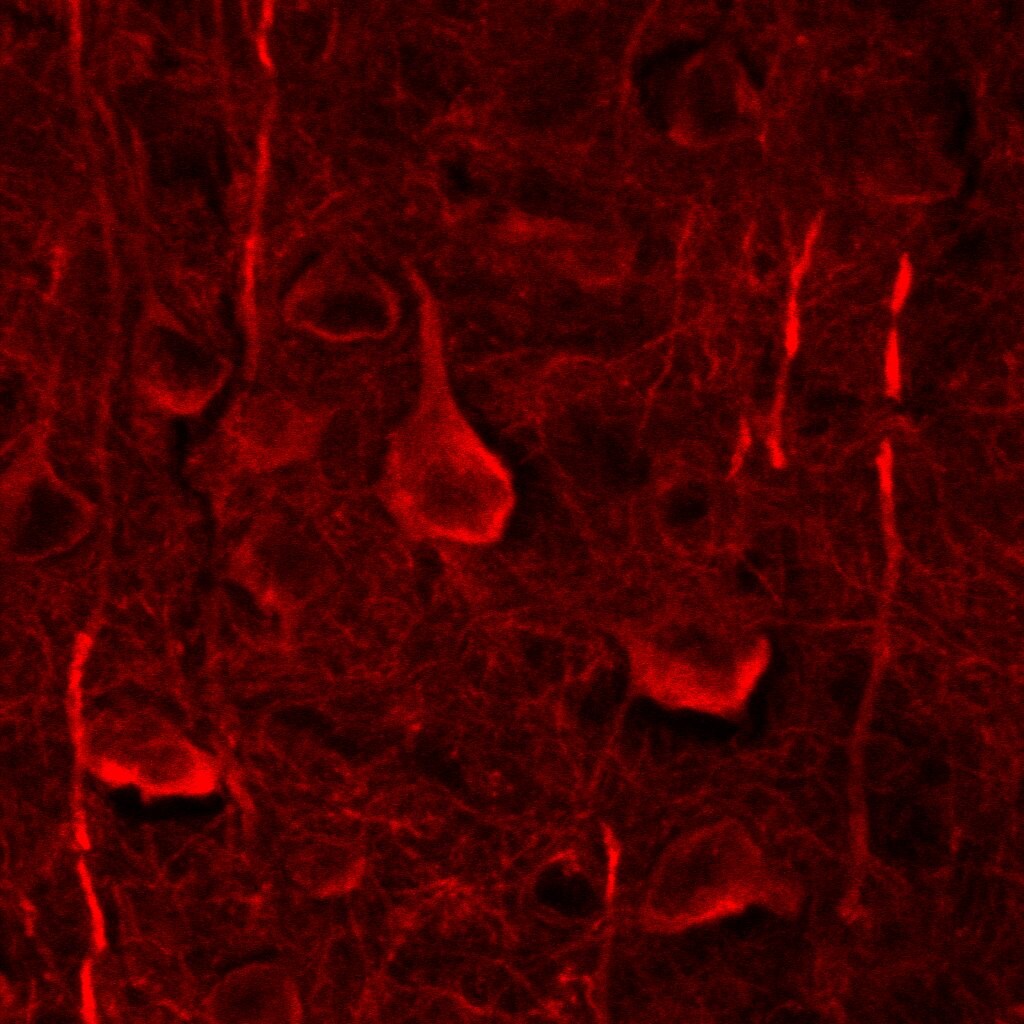 MAP2 Antibody (4H5) - BSA Free NBP2-25156