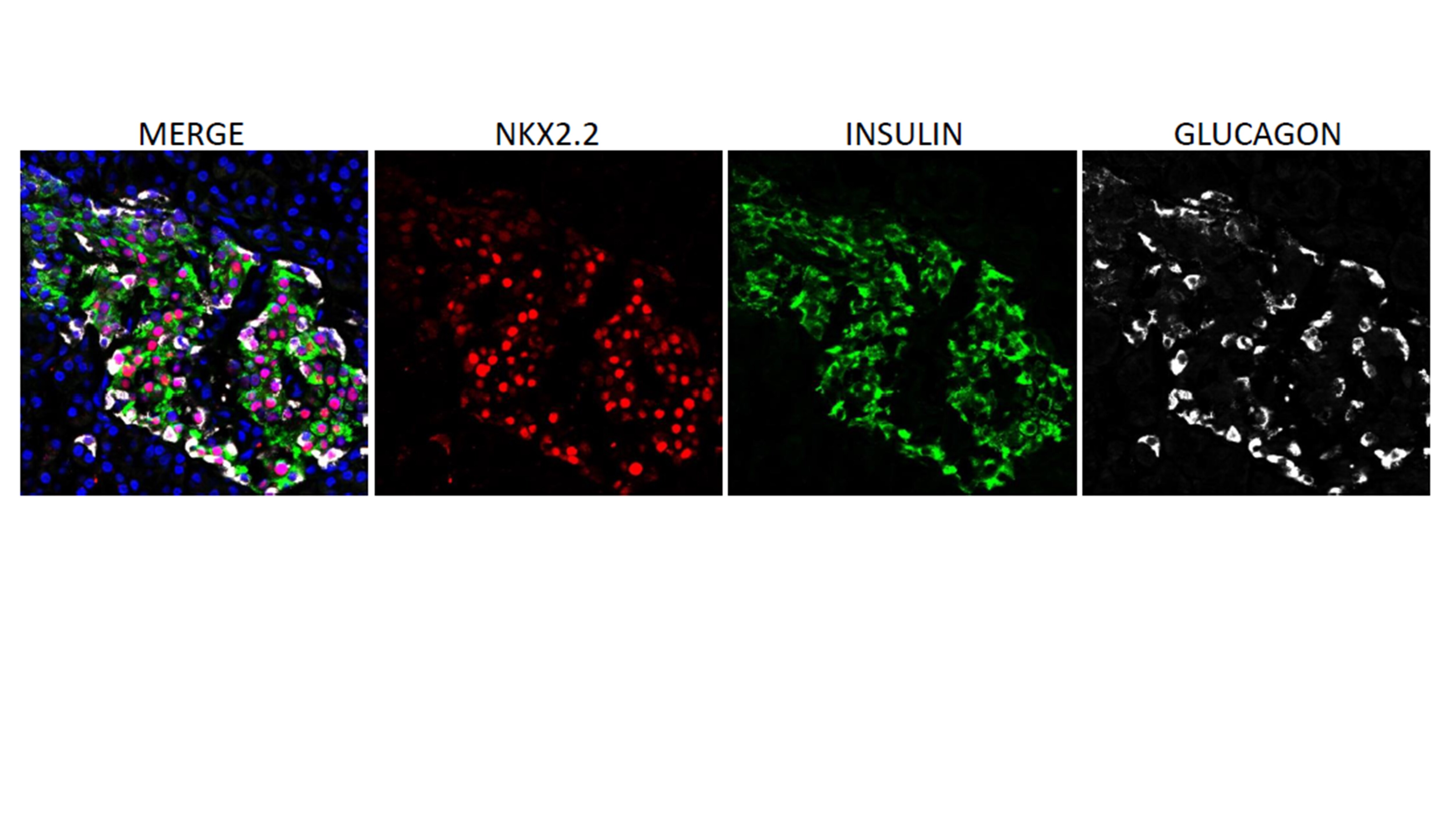 NKX2.2 Antibody (NX2/294) NBP2-29432