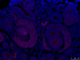 FoxC2 Antibody NB100-1269