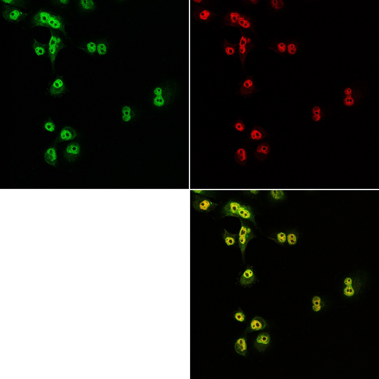 Nup53 Antibody - BSA Free NB100-93322