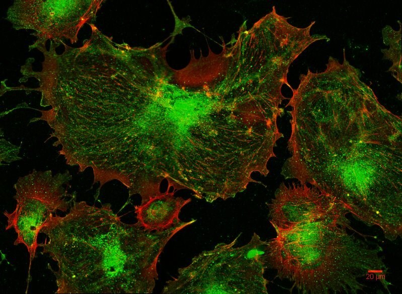 PEAK1 Antibody - BSA Free NBP1-91052