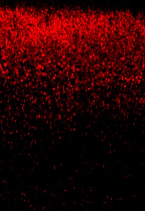 POU3F3 Antibody NBP1-49872