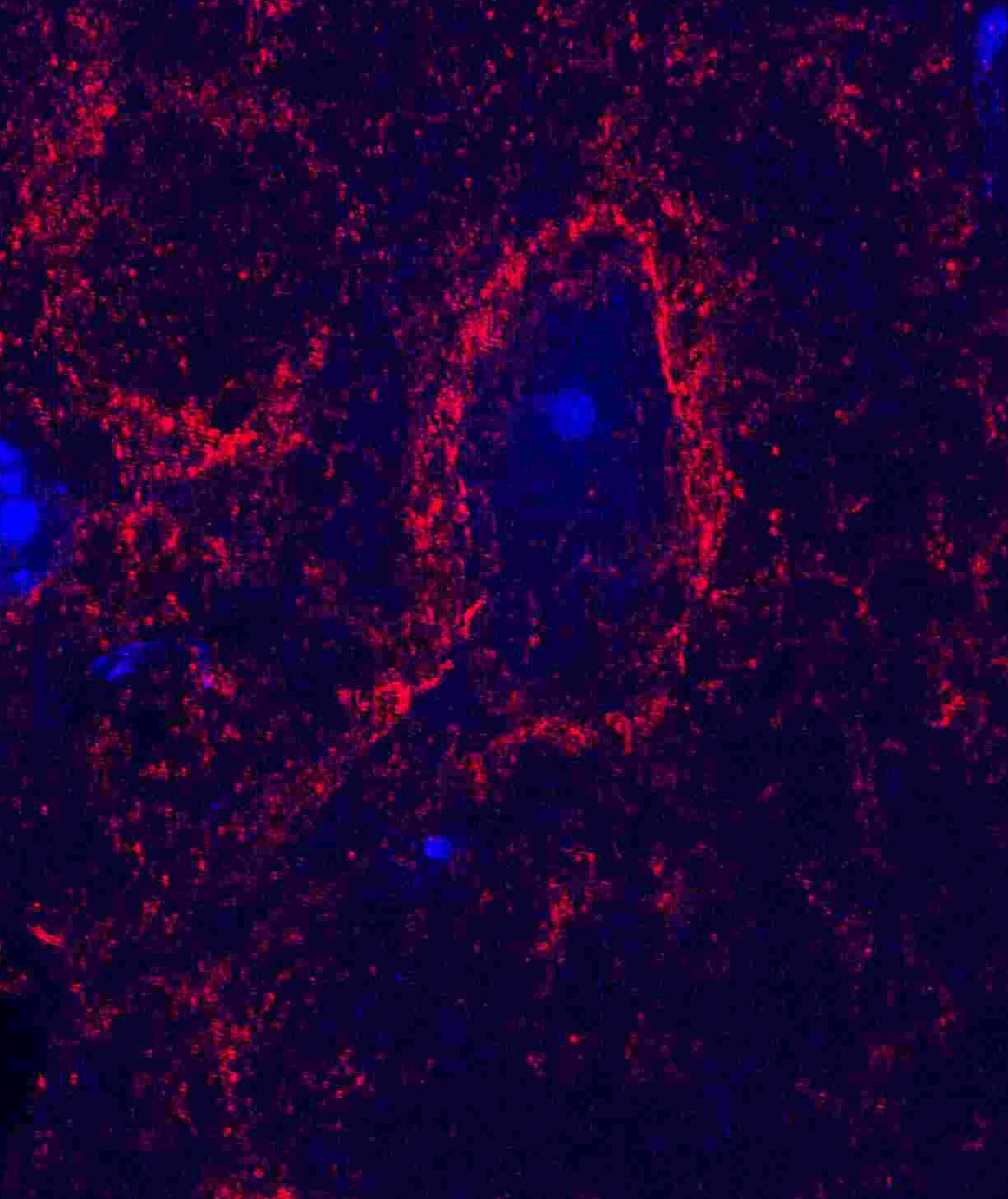 Human Synaptophysin Antibody AF5555