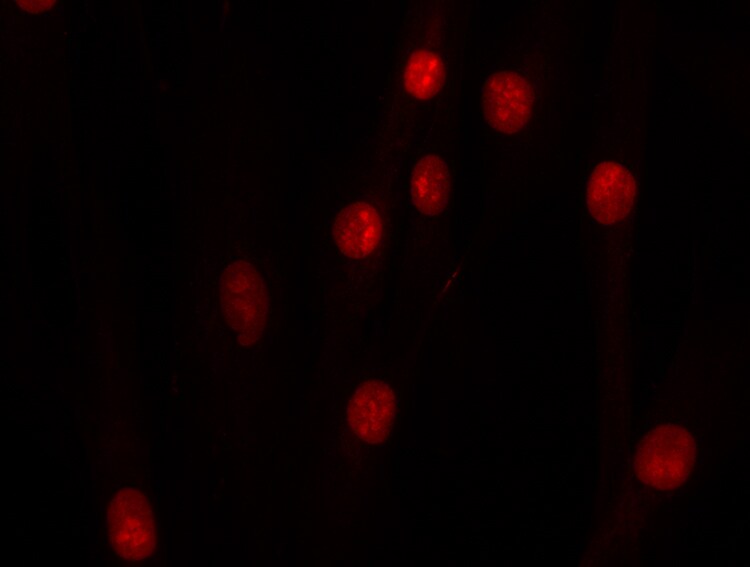 TOP2B Antibody - BSA Free NBP1-89527