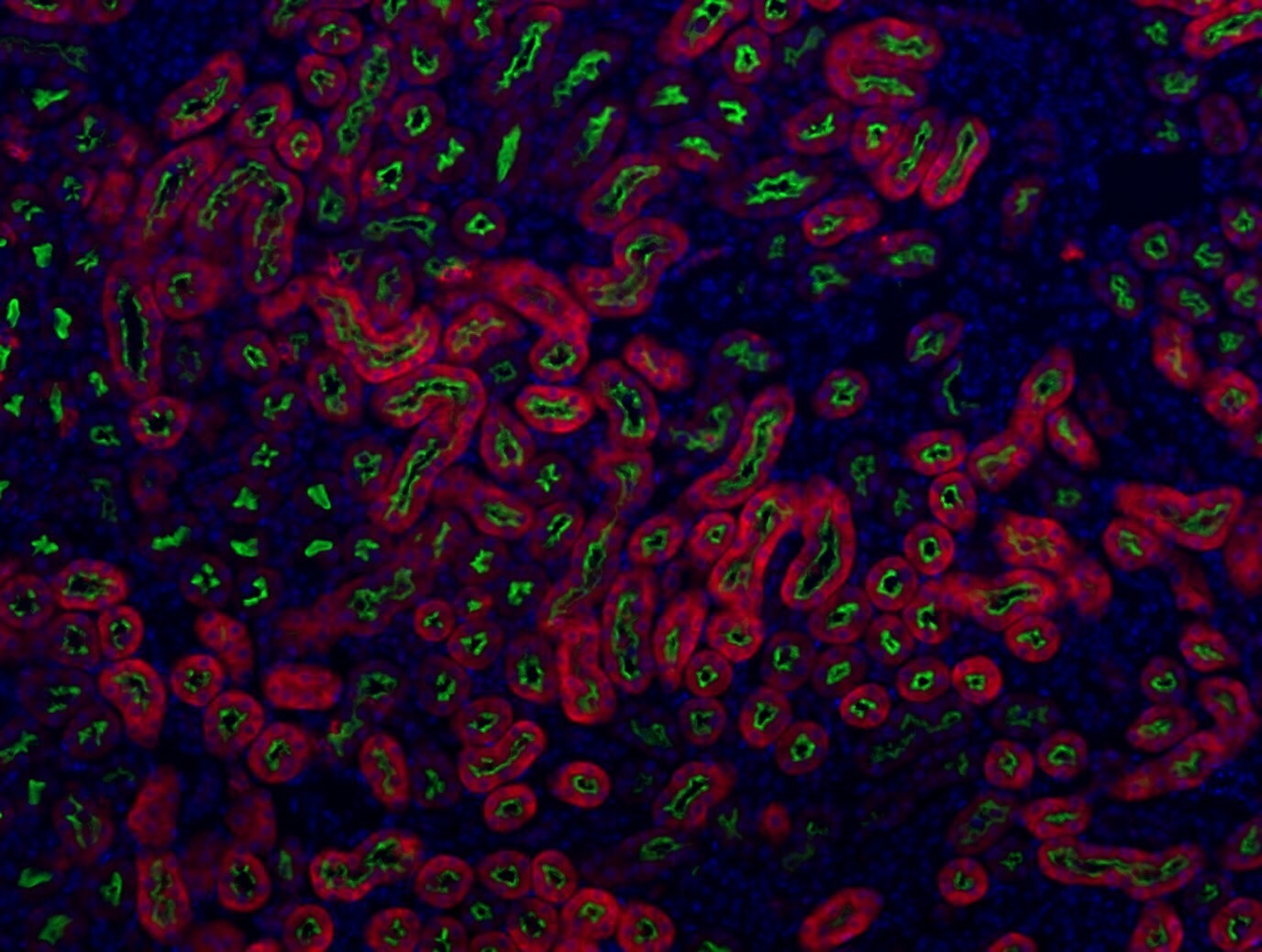 TRPM2 Antibody - BSA Free NBP1-59618