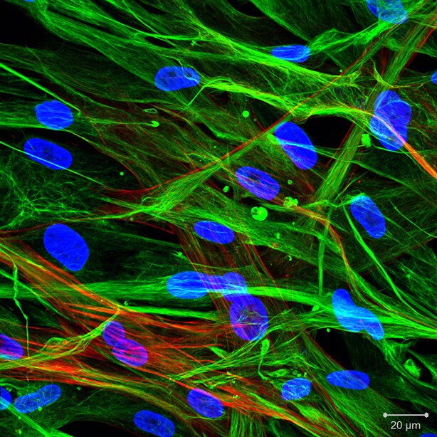 Vimentin Antibody NBP1-31327