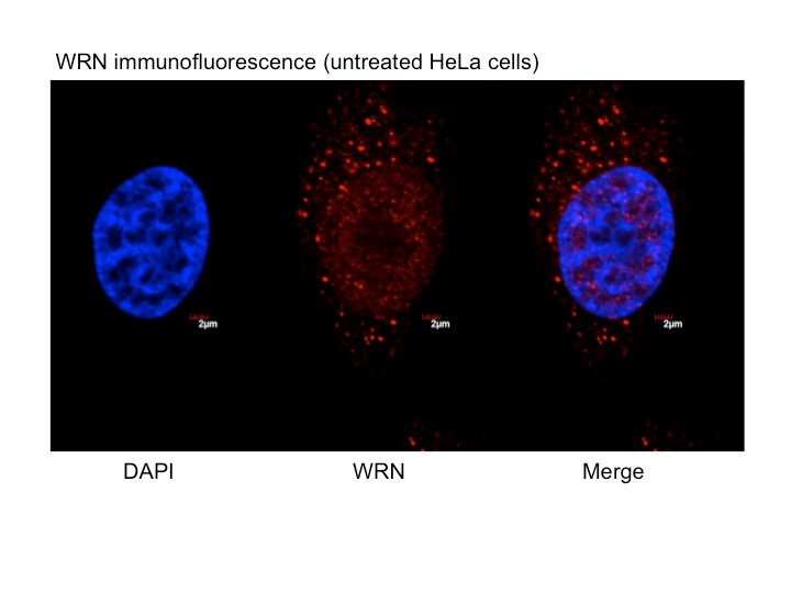 WRN Antibody - BSA Free NB100-471