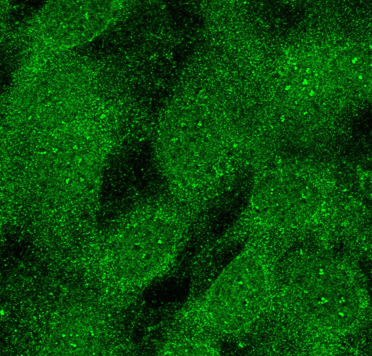 Mouse GLI‑2 Antibody AF3635