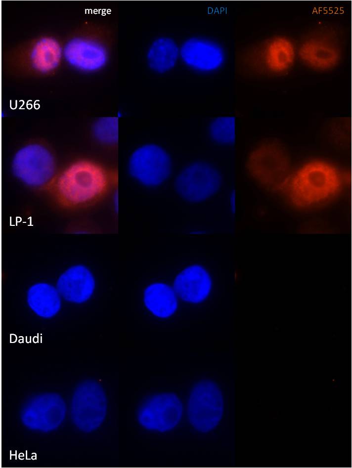 Human IRF4 Antibody AF5525