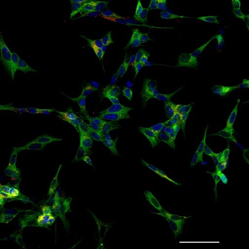 p62/SQSTM1 Antibody (2C11) - Azide and BSA Free H00008878-M01