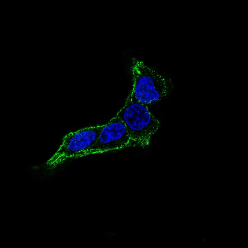 Human CX3CL1/Fractalkine Chemokine Domain Antibody MAB3651